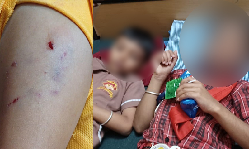 ಸೋಮವಾರಪೇಟೆ: ವಿದ್ಯಾರ್ಥಿಗಳ ಮೇಲೆ ನಾಯಿ ದಾಳಿ; ಆಸ್ಪತ್ರೆಗೆ ದಾಖಲು