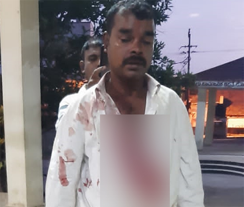 ದೇವರ ಹಾಡು ಹೇಳಲು ಹಿಂಜರಿದ ಆರೋಪ; ದಲಿತ ಯುವಕನ ಮೇಲೆ ಮರಣಾಂತಿಕ ಹಲ್ಲೆ : ಐವರ ಬಂಧನ