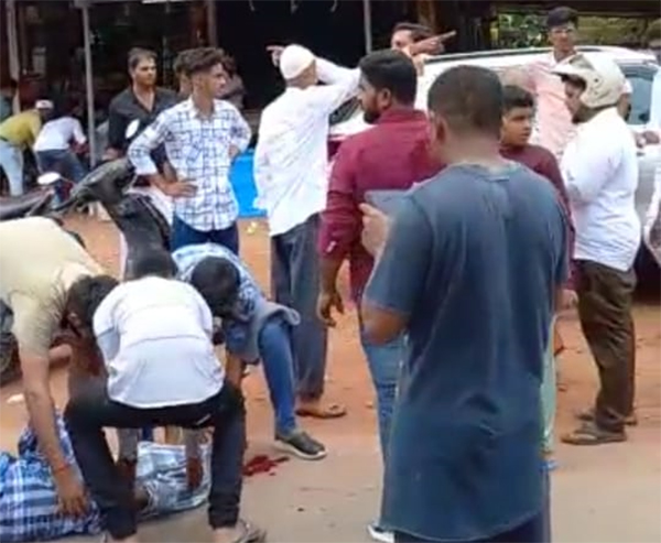 ಸುರತ್ಕಲ್; ಬೈಕ್ ಗಳ‌ ಮಧ್ಯೆ ಮುಖಾಮುಖಿ ಢಿಕ್ಕಿ: ಮೂವರಿಗೆ ಗಾಯ