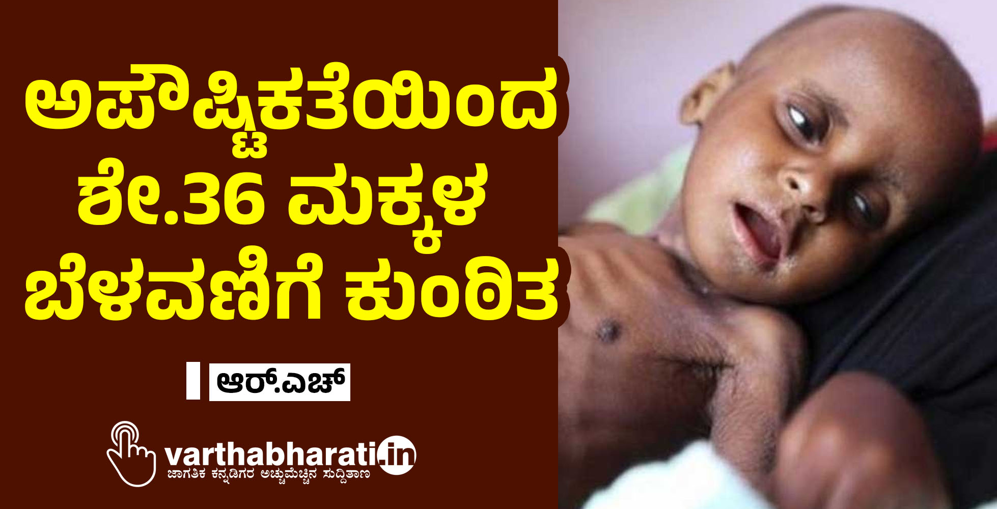 ಅಪೌಷ್ಟಿಕತೆಯಿಂದ ಶೇ.36 ಮಕ್ಕಳ ಬೆಳವಣಿಗೆ ಕುಂಠಿತ