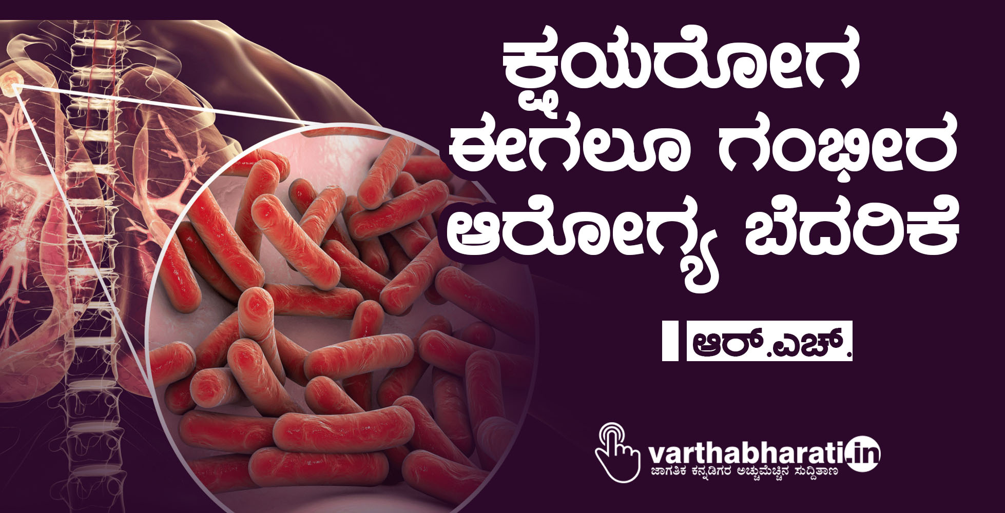 ಕ್ಷಯರೋಗ ಈಗಲೂ ಗಂಭೀರ ಆರೋಗ್ಯ ಬೆದರಿಕೆ