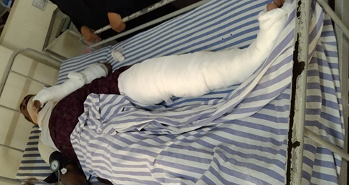 ಹಿಟ್ ಆ್ಯಂಡ್ ರನ್: ಗೃಹರಕ್ಷಕ ಸಿಬ್ಬಂದಿಗೆ ಗಾಯ