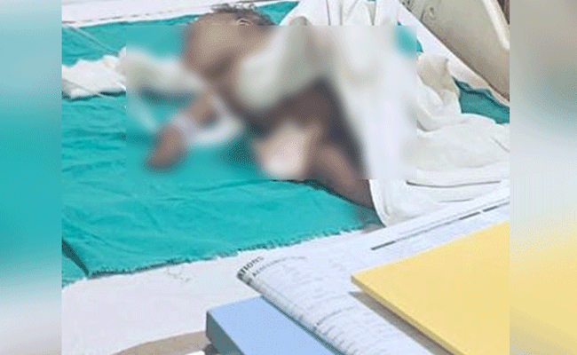 ಬೀದಿ ನಾಯಿ ದಾಳಿಗೆ ಒಂದು ವರ್ಷದ ಮಗು ಮೃತ್ಯು