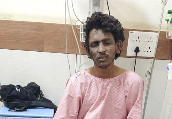 ಕುಕ್ಕರ್ ಬಾಂಬ್ ಸ್ಫೋಟ ಪ್ರಕರಣ: ಚಿಕಿತ್ಸೆಗಾಗಿ ಆರೋಪಿ ಶಾರಿಕ್ ಬೆಂಗಳೂರಿಗೆ