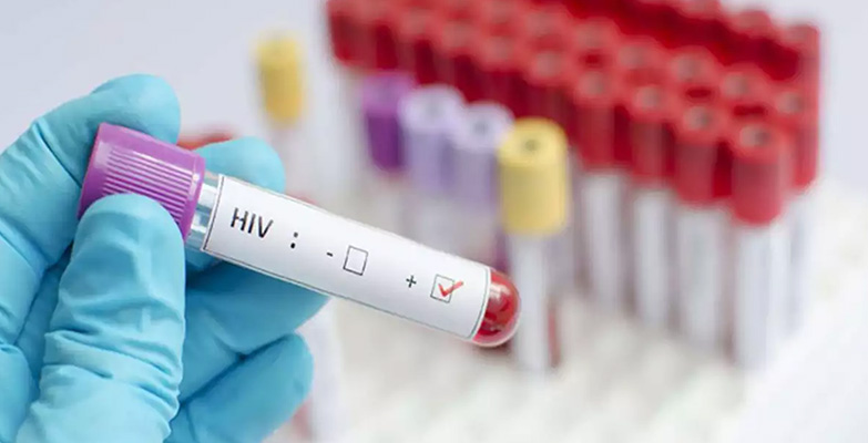 ​ಎಚ್‍ಐವಿ ಪಾಸಿಟಿವ್ ಶಿಕ್ಷಕನಿಗೆ ಸುಧೀರ್ಘ ರಜೆ ಶಿಕ್ಷೆ!