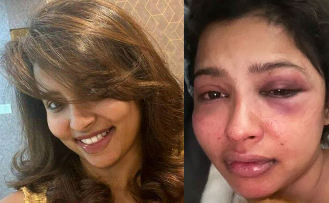 ಮಾಜಿ ಗೆಳೆಯನಿಂದ ಹಲ್ಲೆ, ಬೆದರಿಕೆ: ಮಲಯಾಳಂ ನಟಿ ಅನಿಕಾ ಆರೋಪ