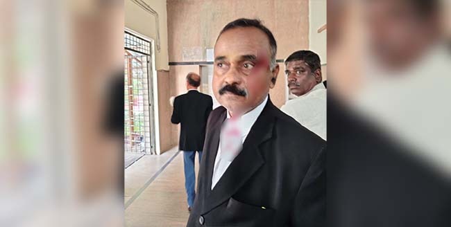 ಬೆಂಗಳೂರು: ಕೋರ್ಟ್ ಆವರಣದಲ್ಲೇ ವಕೀಲರ ಮೇಲೆ ಚಾಕುವಿನಿಂದ ಹಲ್ಲೆ ನಡೆಸಿದ ಯುವತಿ