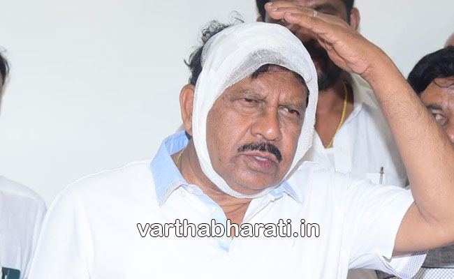 ಕಲ್ಲೇಟು ತಿಂದಿರುವ ನನಗೆ ಡ್ರಾಮಾ ಮಾಡುವ ಅಗತ್ಯವಿಲ್ಲ: ಕುಮಾರಸ್ವಾಮಿಗೆ ಪರಮೇಶ್ವರ್ ತಿರುಗೇಟು