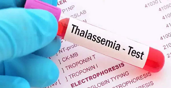 ವಿಶ್ವ ಥಲಸ್ಸೆಮಿಯಾ ದಿನಾಚರಣೆಯ ಅಂಗವಾಗಿ ಮಣಿಪಾಲ ಕೆಎಂಸಿಯಲ್ಲಿ ಎಚ್‌ಎಲ್‌ಎ ಪರೀಕ್ಷಾ  ಶಿಬಿರ